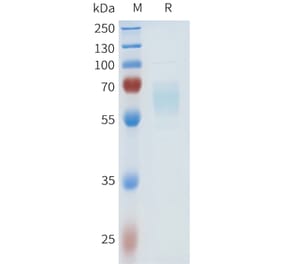 SDS-PAGE - Recombinant Human HHLA2 Protein (C-terminal hFc Tag) (A332971) - Antibodies.com