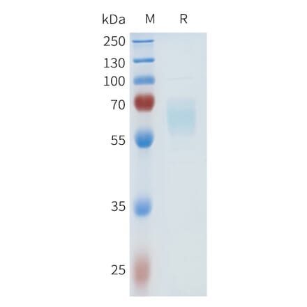 SDS-PAGE - Recombinant Human HHLA2 Protein (C-terminal hFc Tag) (A332971) - Antibodies.com