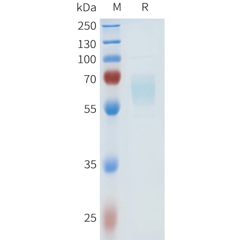 SDS-PAGE - Recombinant Human HHLA2 Protein (C-terminal hFc Tag) (A332971) - Antibodies.com