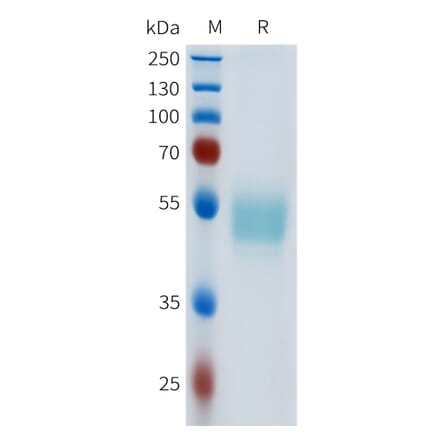 SDS-PAGE - Recombinant Human c-Kit Protein (C-terminal hFc Tag) (A332972) - Antibodies.com