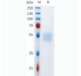 SDS-PAGE - Recombinant Human c-Kit Protein (C-terminal hFc Tag) (A332973) - Antibodies.com