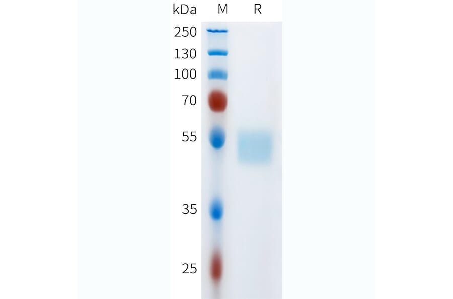 SDS-PAGE - Recombinant Human c-Kit Protein (C-terminal hFc Tag) (A332973) - Antibodies.com