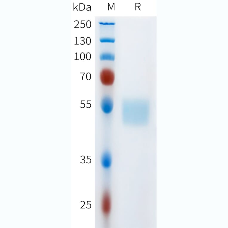 SDS-PAGE - Recombinant Human c-Kit Protein (C-terminal hFc Tag) (A332973) - Antibodies.com