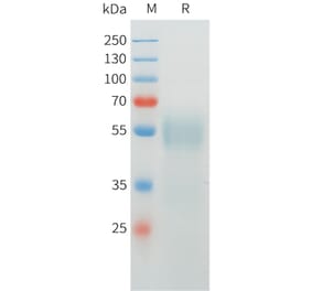 SDS-PAGE - Recombinant Cynomolgus CRTAM Protein (C-terminal 10xHis Tag) (A332974) - Antibodies.com