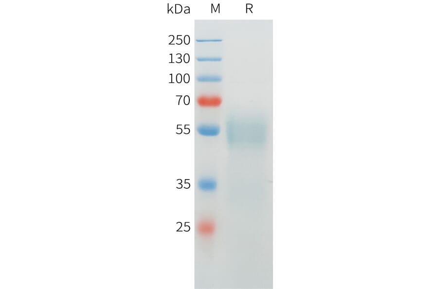 SDS-PAGE - Recombinant Cynomolgus CRTAM Protein (C-terminal 10xHis Tag) (A332974) - Antibodies.com