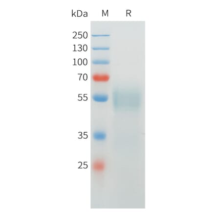 SDS-PAGE - Recombinant Cynomolgus CRTAM Protein (C-terminal 10xHis Tag) (A332974) - Antibodies.com