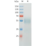 SDS-PAGE - Recombinant Cynomolgus CRTAM Protein (C-terminal 10xHis Tag) (A332974) - Antibodies.com