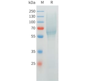 SDS-PAGE - Recombinant Cynomolgus MUC1 Protein (C-terminal 10xHis Tag) (A332975) - Antibodies.com