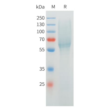 SDS-PAGE - Recombinant Cynomolgus MUC1 Protein (C-terminal 10xHis Tag) (A332975) - Antibodies.com