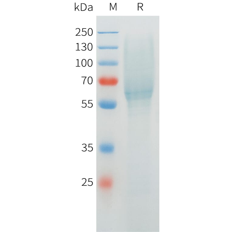 SDS-PAGE - Recombinant Cynomolgus MUC1 Protein (C-terminal 10xHis Tag) (A332975) - Antibodies.com