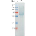 SDS-PAGE - Recombinant Cynomolgus MUC1 Protein (C-terminal 10xHis Tag) (A332975) - Antibodies.com