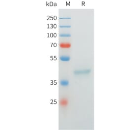 SDS-PAGE - Recombinant Cynomolgus MUC1 Protein (C-terminal mFc Tag) (A332977) - Antibodies.com