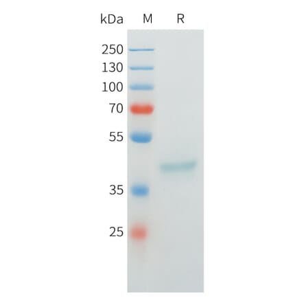 SDS-PAGE - Recombinant Cynomolgus MUC1 Protein (C-terminal mFc Tag) (A332977) - Antibodies.com