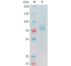 SDS-PAGE - Recombinant Cynomolgus Glypican 3 Protein (C-terminal 10xHis Tag) (A332978) - Antibodies.com