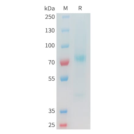 SDS-PAGE - Recombinant Cynomolgus Glypican 3 Protein (C-terminal 10xHis Tag) (A332978) - Antibodies.com