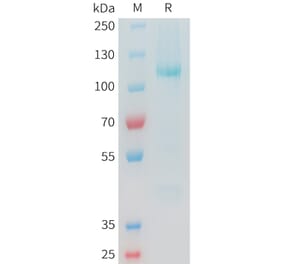 SDS-PAGE - Recombinant Cynomolgus Glypican 3 Protein (C-terminal hFc Tag) (A332979) - Antibodies.com