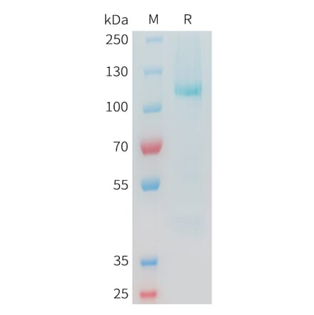 SDS-PAGE - Recombinant Cynomolgus Glypican 3 Protein (C-terminal hFc Tag) (A332979) - Antibodies.com