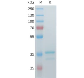 SDS-PAGE - Recombinant Cynomolgus Glypican 3 Protein (N-terminal hFc Tag) (A332980) - Antibodies.com