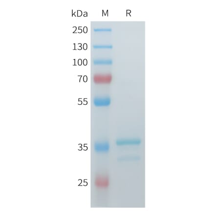SDS-PAGE - Recombinant Cynomolgus Glypican 3 Protein (N-terminal hFc Tag) (A332980) - Antibodies.com