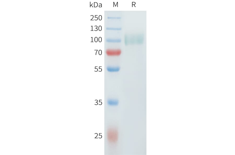 SDS-PAGE - Recombinant Cynomolgus ErbB2 Protein (C-terminal 10xHis Tag) (A332981) - Antibodies.com