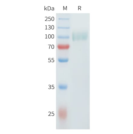 SDS-PAGE - Recombinant Cynomolgus ErbB2 Protein (C-terminal 10xHis Tag) (A332981) - Antibodies.com