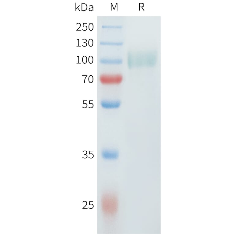 SDS-PAGE - Recombinant Cynomolgus ErbB2 Protein (C-terminal 10xHis Tag) (A332981) - Antibodies.com