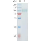 SDS-PAGE - Recombinant Cynomolgus ErbB2 Protein (C-terminal 10xHis Tag) (A332981) - Antibodies.com
