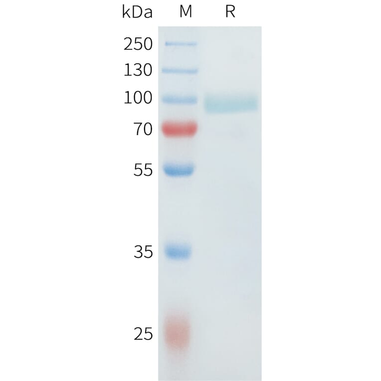 SDS-PAGE - Recombinant Cynomolgus SLC39A6 Protein (C-terminal hFc Tag) (A332982) - Antibodies.com