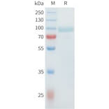 SDS-PAGE - Recombinant Cynomolgus SLC39A6 Protein (C-terminal hFc Tag) (A332982) - Antibodies.com
