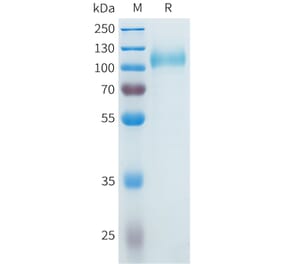 SDS-PAGE - Recombinant Cynomolgus CDCP1 Protein (C-terminal 10xHis Tag) (A332983) - Antibodies.com