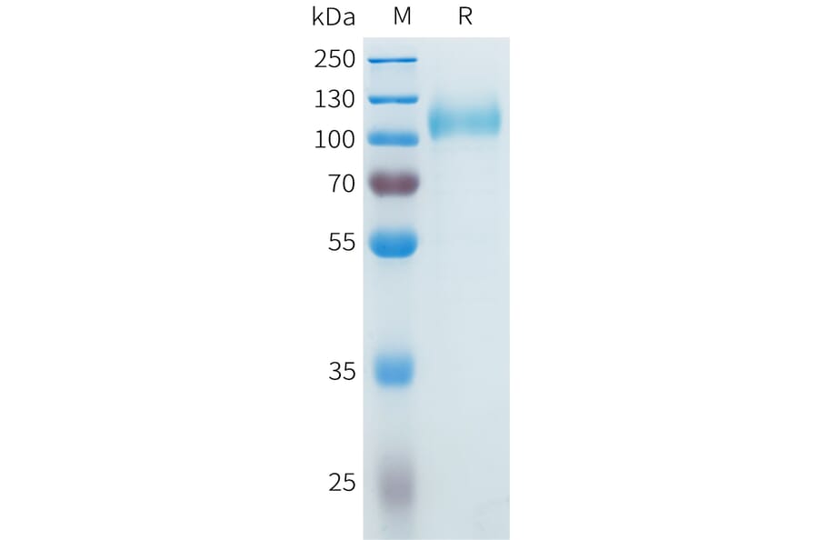 SDS-PAGE - Recombinant Cynomolgus CDCP1 Protein (C-terminal 10xHis Tag) (A332983) - Antibodies.com