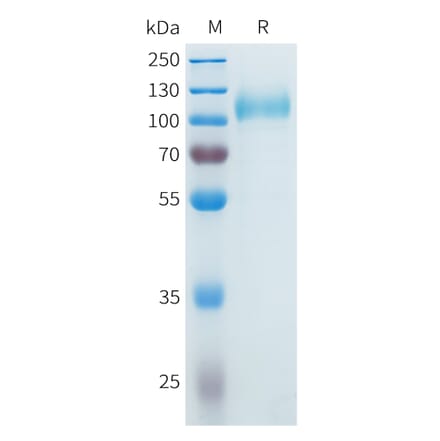SDS-PAGE - Recombinant Cynomolgus CDCP1 Protein (C-terminal 10xHis Tag) (A332983) - Antibodies.com