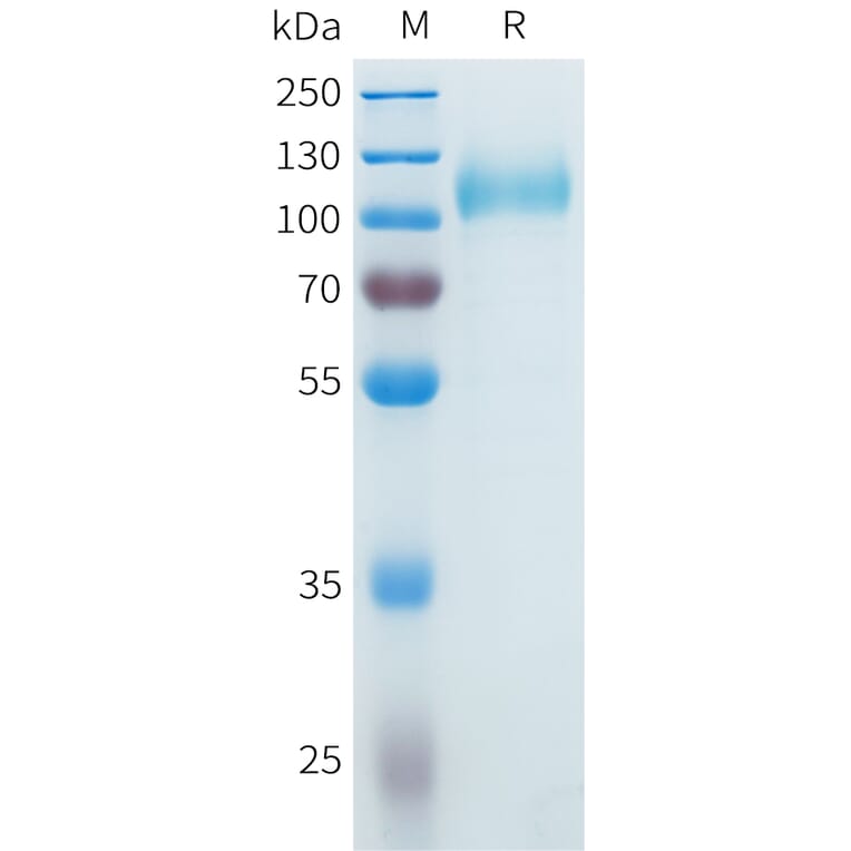 SDS-PAGE - Recombinant Cynomolgus CDCP1 Protein (C-terminal 10xHis Tag) (A332983) - Antibodies.com