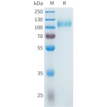 SDS-PAGE - Recombinant Cynomolgus CDCP1 Protein (C-terminal 10xHis Tag) (A332983) - Antibodies.com