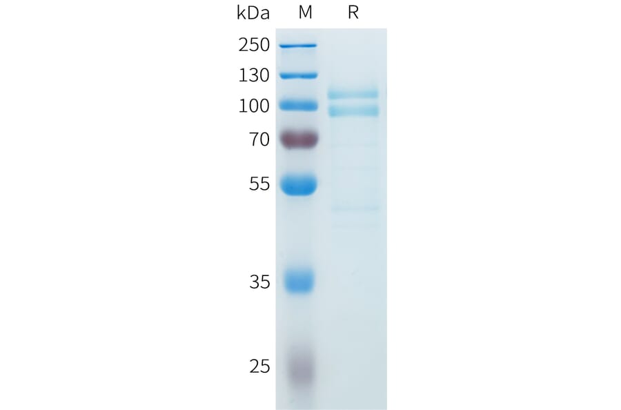 SDS-PAGE - Recombinant Cynomolgus P-Cadherin Protein (C-terminal 10xHis Tag) (A332984) - Antibodies.com