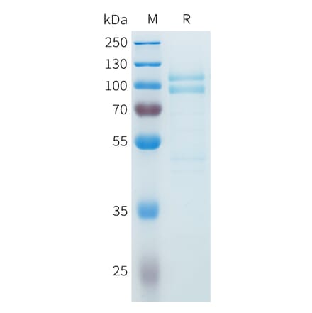SDS-PAGE - Recombinant Cynomolgus P-Cadherin Protein (C-terminal 10xHis Tag) (A332984) - Antibodies.com