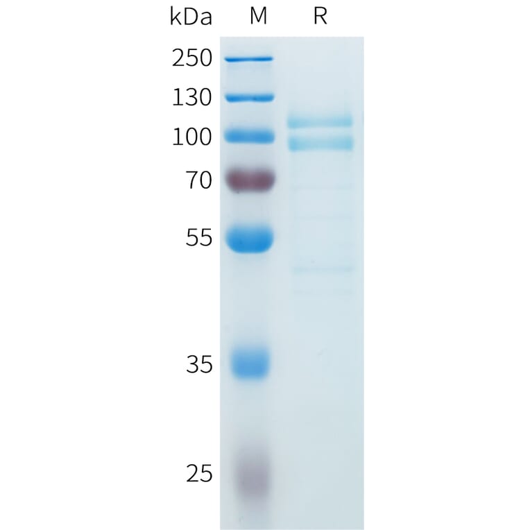 SDS-PAGE - Recombinant Cynomolgus P-Cadherin Protein (C-terminal 10xHis Tag) (A332984) - Antibodies.com