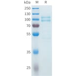 SDS-PAGE - Recombinant Cynomolgus P-Cadherin Protein (C-terminal 10xHis Tag) (A332984) - Antibodies.com