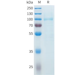 SDS-PAGE - Recombinant Cynomolgus SLITRK6 Protein (C-terminal 10xHis Tag) (A332985) - Antibodies.com