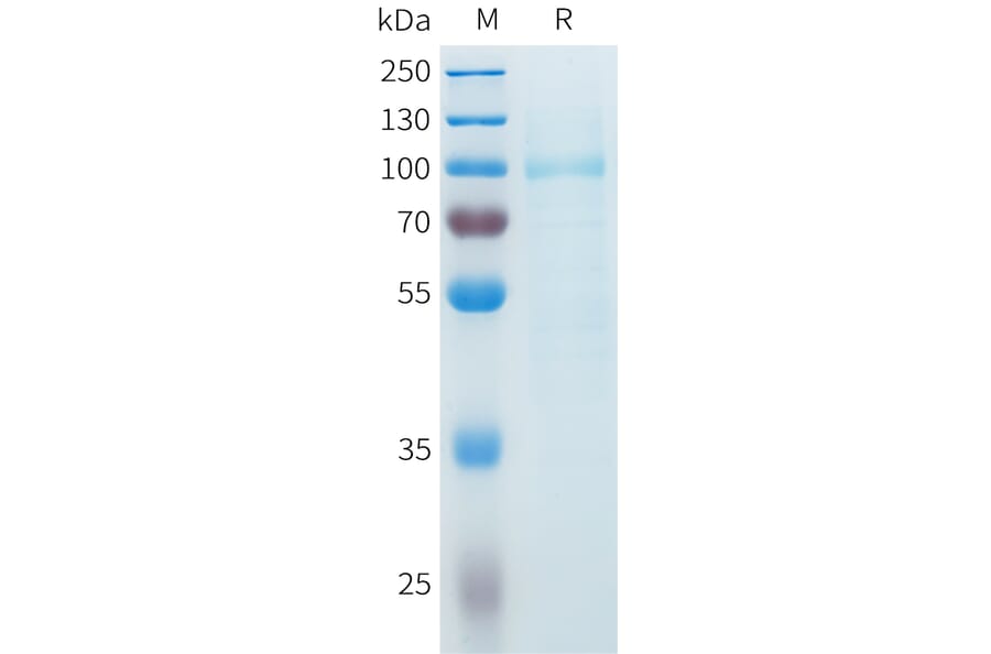 SDS-PAGE - Recombinant Cynomolgus SLITRK6 Protein (C-terminal 10xHis Tag) (A332985) - Antibodies.com