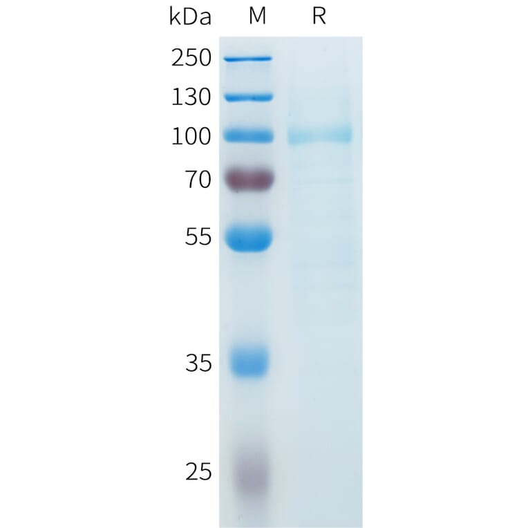 SDS-PAGE - Recombinant Cynomolgus SLITRK6 Protein (C-terminal 10xHis Tag) (A332985) - Antibodies.com