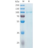 SDS-PAGE - Recombinant Cynomolgus SLITRK6 Protein (C-terminal 10xHis Tag) (A332985) - Antibodies.com