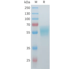 SDS-PAGE - Recombinant Mouse ACVR2A Protein (C-terminal hFc Tag) (A332986) - Antibodies.com