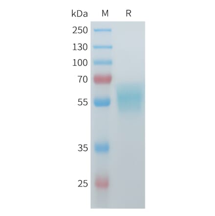 SDS-PAGE - Recombinant Mouse ACVR2A Protein (C-terminal hFc Tag) (A332986) - Antibodies.com