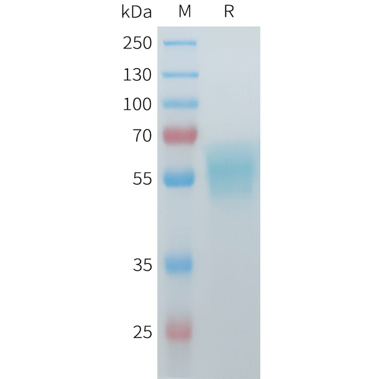 SDS-PAGE - Recombinant Mouse ACVR2A Protein (C-terminal hFc Tag) (A332986) - Antibodies.com