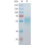 SDS-PAGE - Recombinant Mouse ACVR2A Protein (C-terminal hFc Tag) (A332986) - Antibodies.com