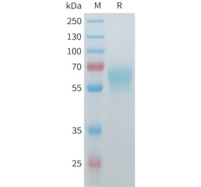 SDS-PAGE - Recombinant Mouse ACVR2B Protein (C-terminal hFc Tag) (A332987) - Antibodies.com