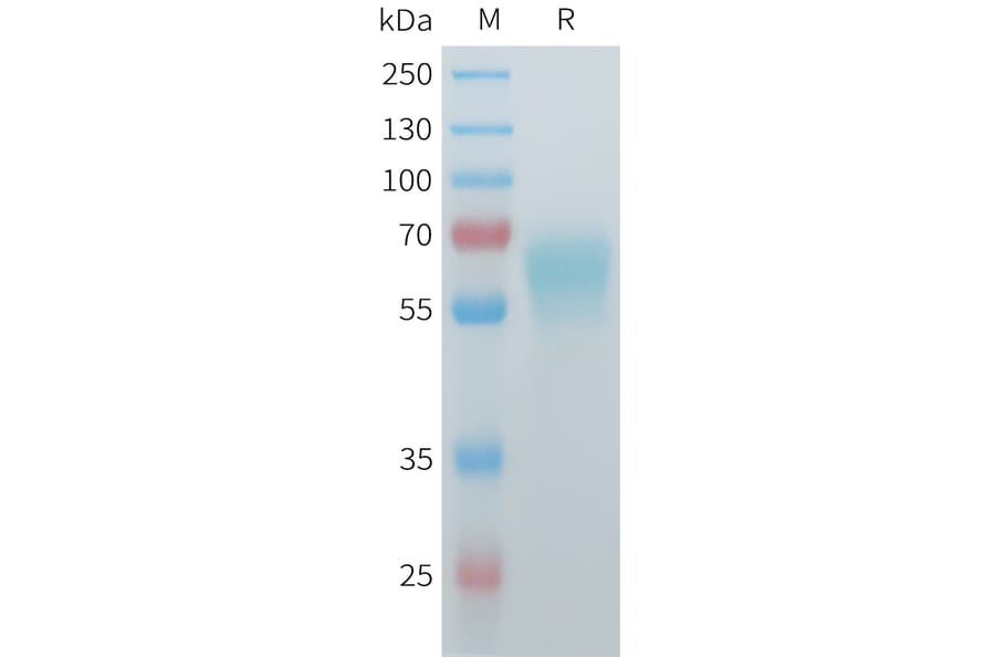 SDS-PAGE - Recombinant Mouse ACVR2B Protein (C-terminal hFc Tag) (A332987) - Antibodies.com