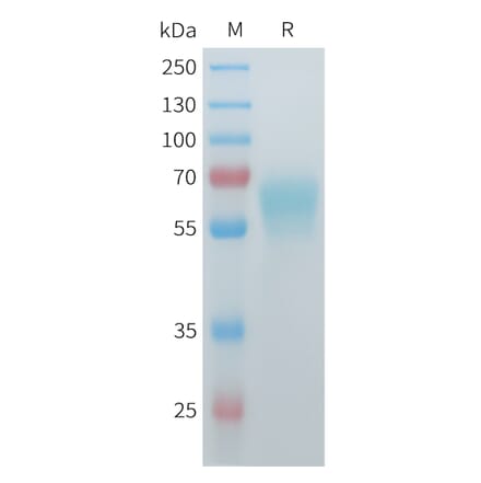 SDS-PAGE - Recombinant Mouse ACVR2B Protein (C-terminal hFc Tag) (A332987) - Antibodies.com