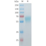 SDS-PAGE - Recombinant Mouse ACVR2B Protein (C-terminal hFc Tag) (A332987) - Antibodies.com